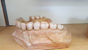 vilica zub